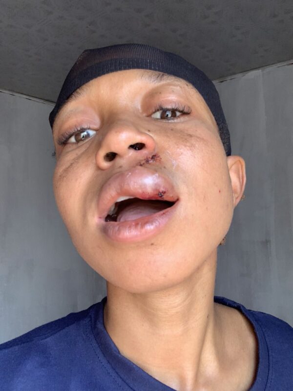 “In this life, don’t help anybody” Woman warns after man she lent money assaulted her and absconded when she asked to be paid back (video)