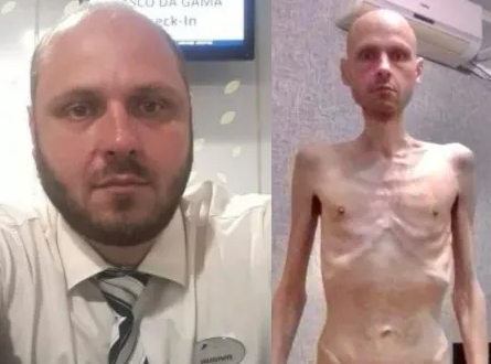 Shocking before and after photos show condition of Ukrainian soldier released by Russia (photos)