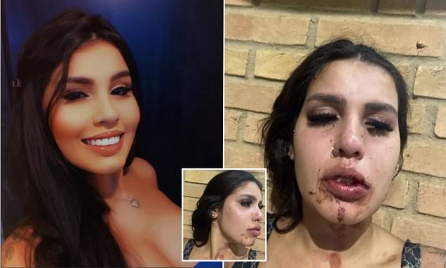 Instagram star is ‘drugged, gang-r@ped and beaten by her fellow influencers who invited her to a party